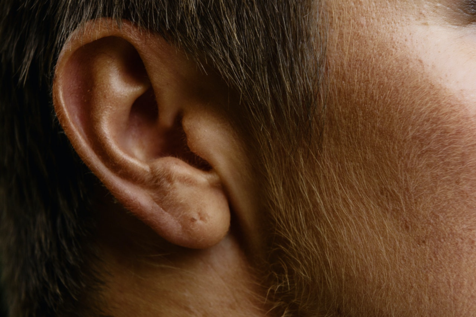 Zumbidos en los oídos: acufenos y tinnitus | Leon Monzón
